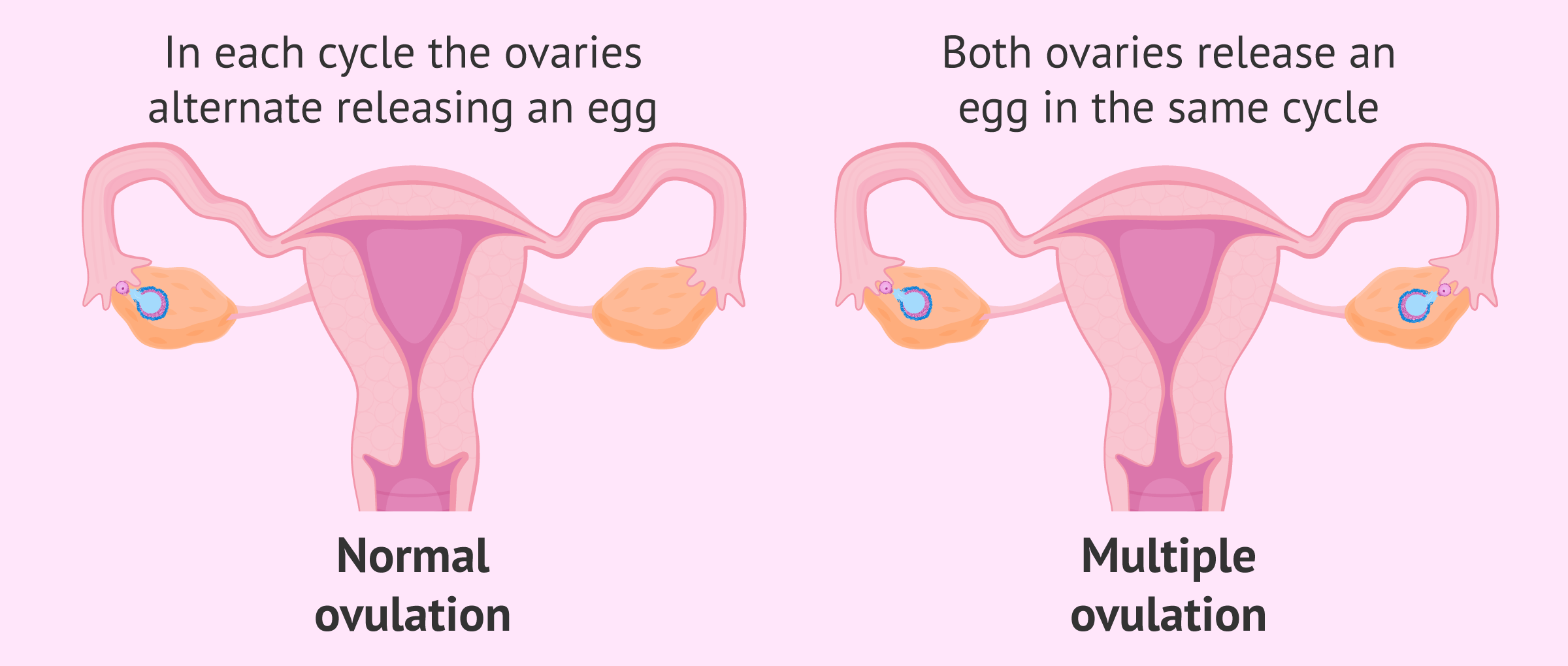 What Is Multiple Ovulation? Definition & Causes