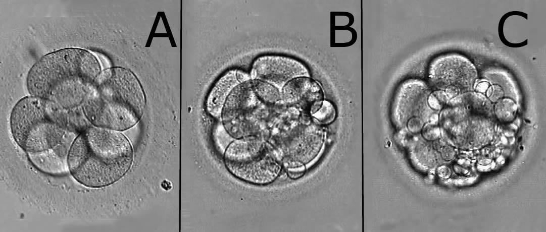 Classification of embryos according to their quality