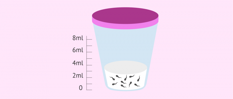 What Is a Semen Analysis Report? Purpose, Preparation & Cost