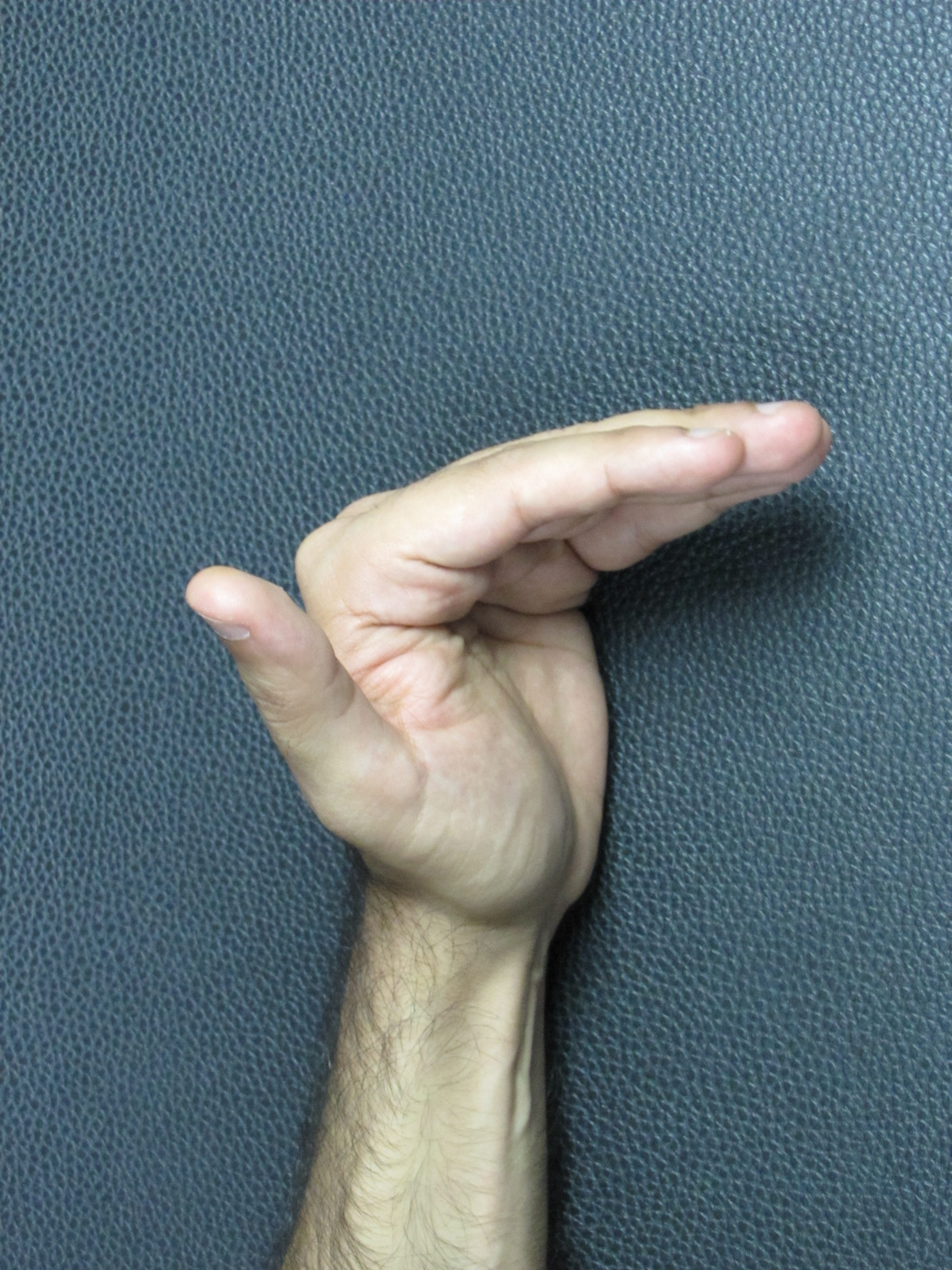 IPC Physical Therapy Center Hand exercises/Hand tendon gliding