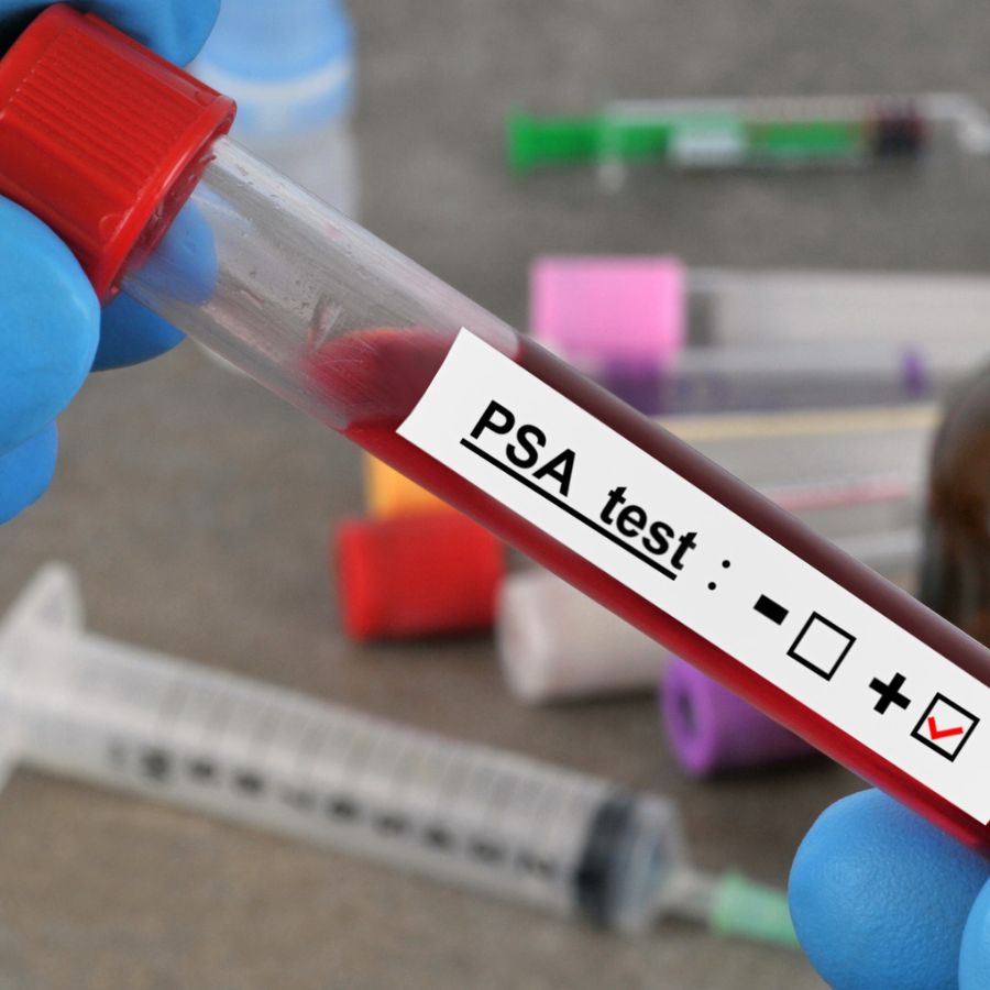 PSA Screening test Doctors Who CARE