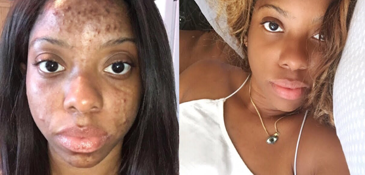 BETAC SERUM » ISIS.GOLD