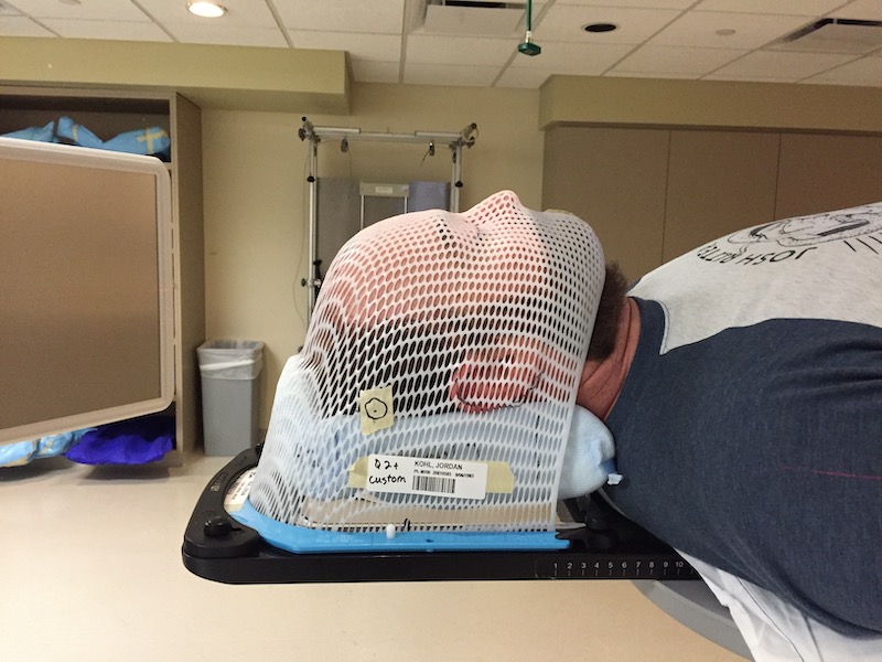 Radiation treatment · I Smell Chips