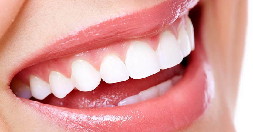 Reston Dental iSmile Dental Care Safe Teeth Whitening