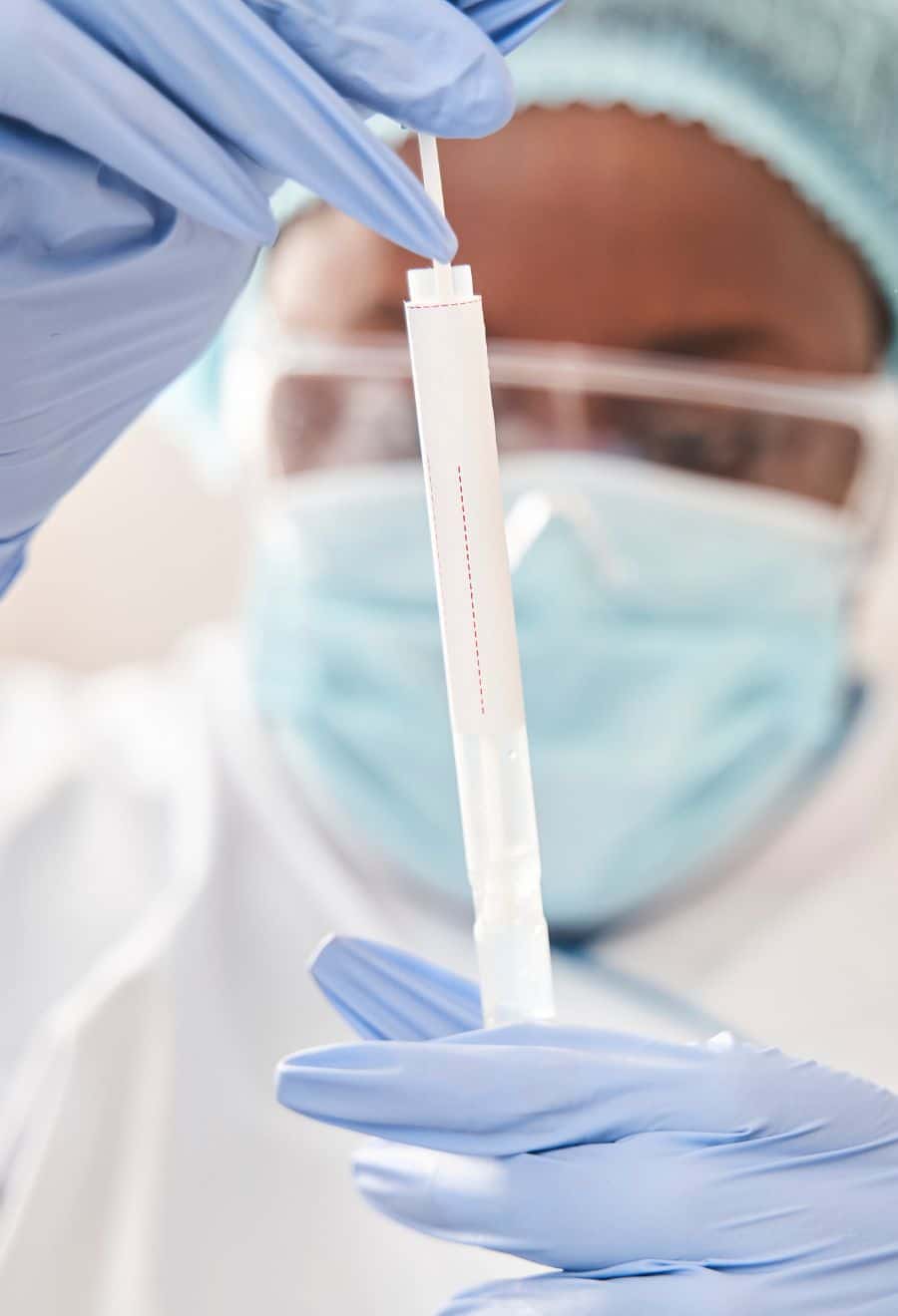 Human Sputum Samples iSpecimen