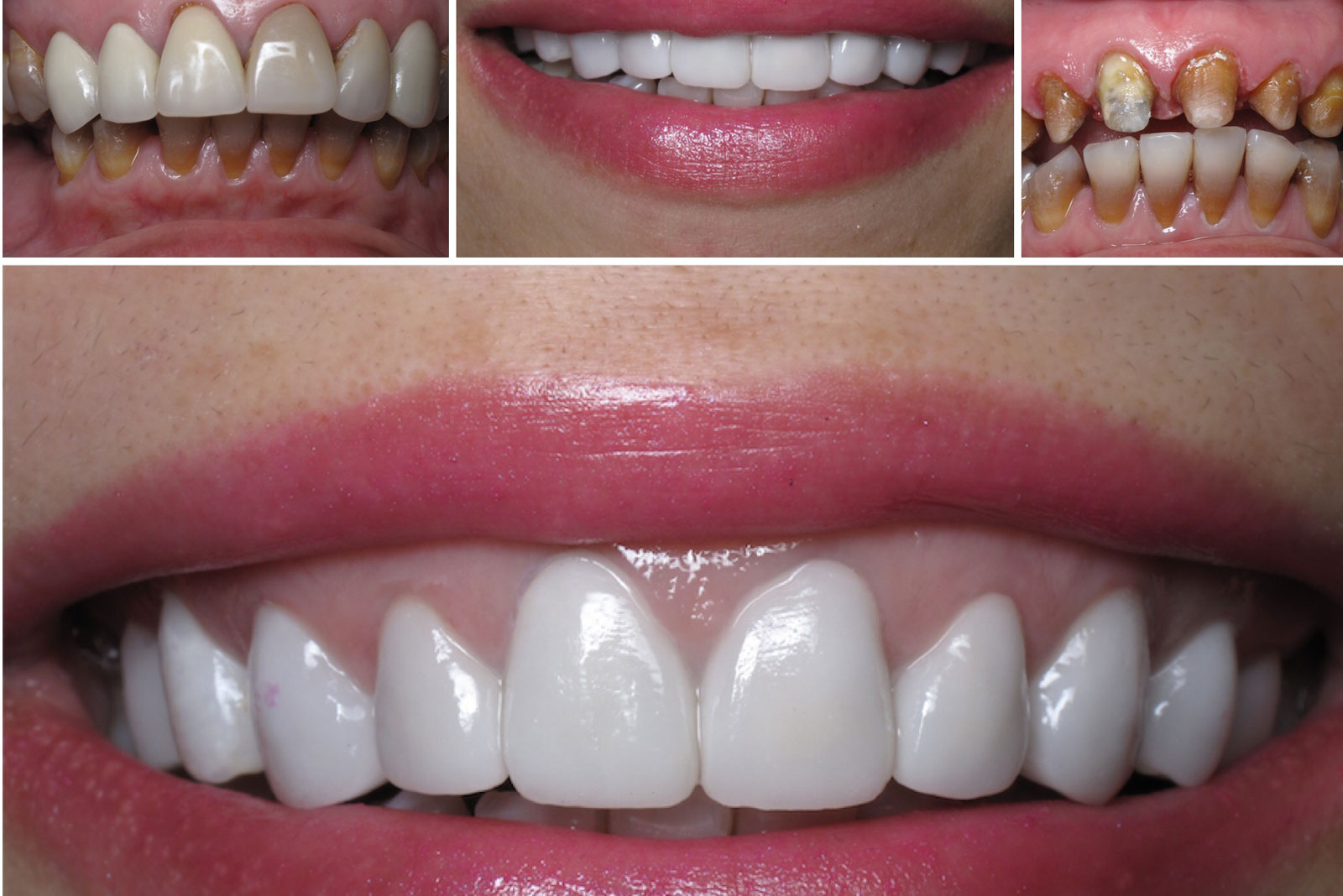 CAD CAM INTELLIGENT TOUCH DENTAL LABORATORY