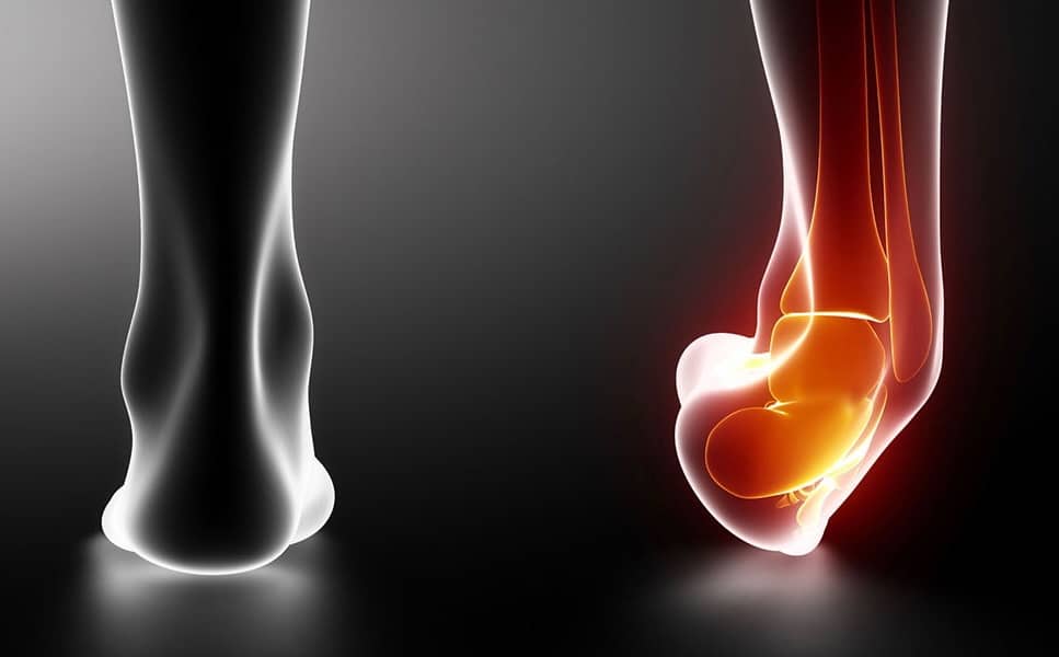 When to Ice or Heat a Foot or Ankle Injury JAWS Podiatry