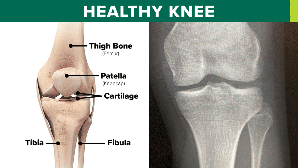 Orthopaedics & Sports Medicine JCMG