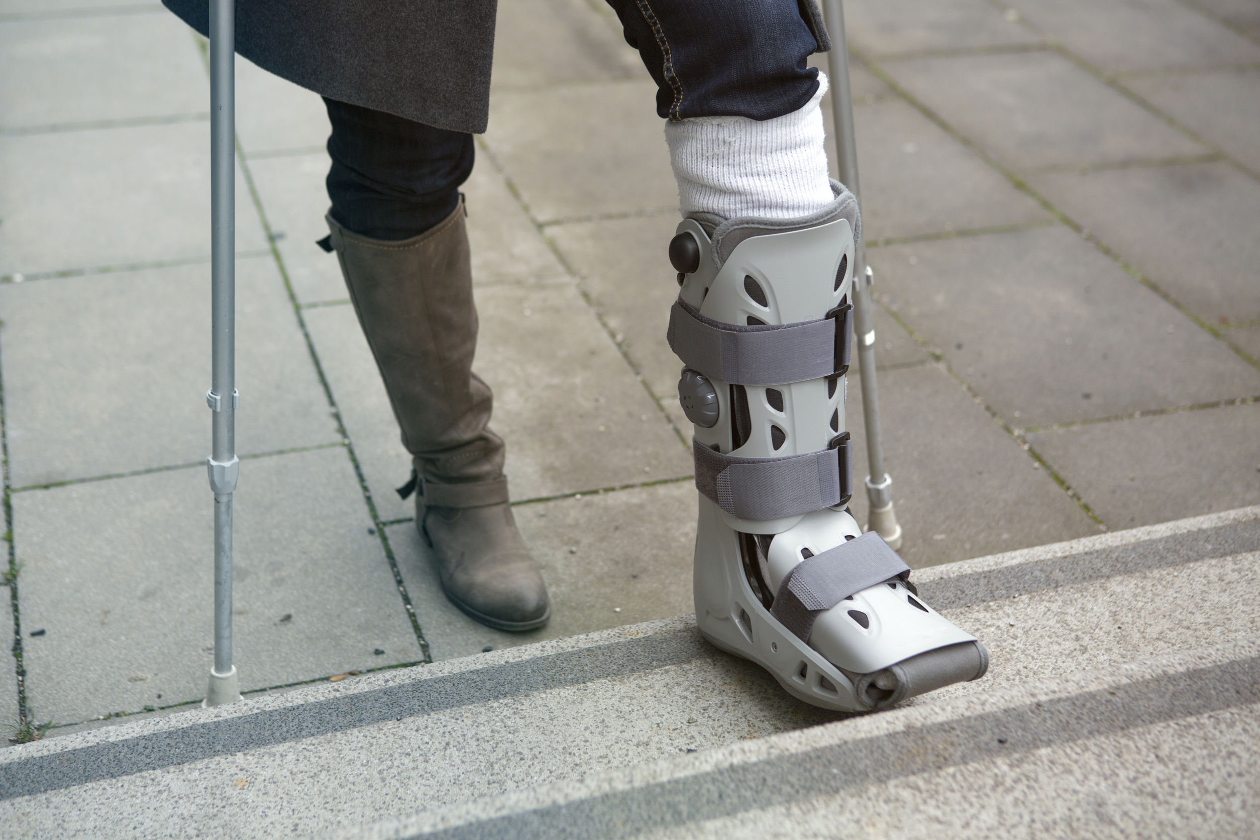 What Ankle Fracture Treatment Is Right For You? Jeffrey H. Berg, M.D.