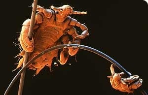 Straight No Chaser Stds Pubic Lice Crabs Jeffrey Sterling Md