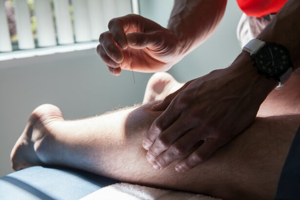 IMS Intramuscular StimulationDry NeedlingJericho Physio