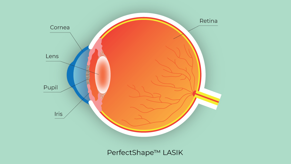 Jerry Tan Eye Surgery Singapore Types Of Customised Lasik