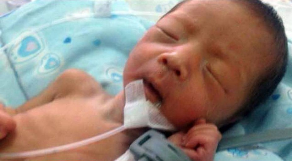 Un bébé supposé mortné survit après avoir été enterré pendant 2 heures