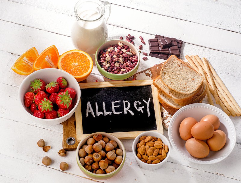 Food Allergies Got You Down? Here’s Your Essential Guide to AllergyFriendly Alternatives Dr