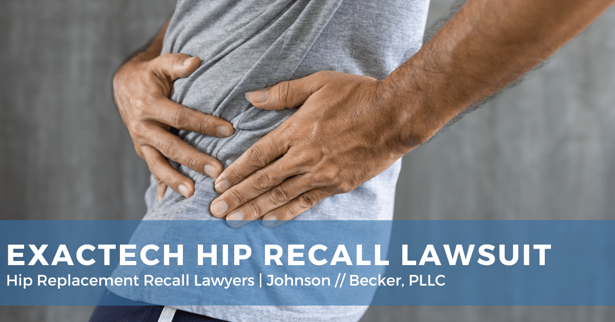 Exactech Hip Replacement Recall Lawsuit Johnson//Becker