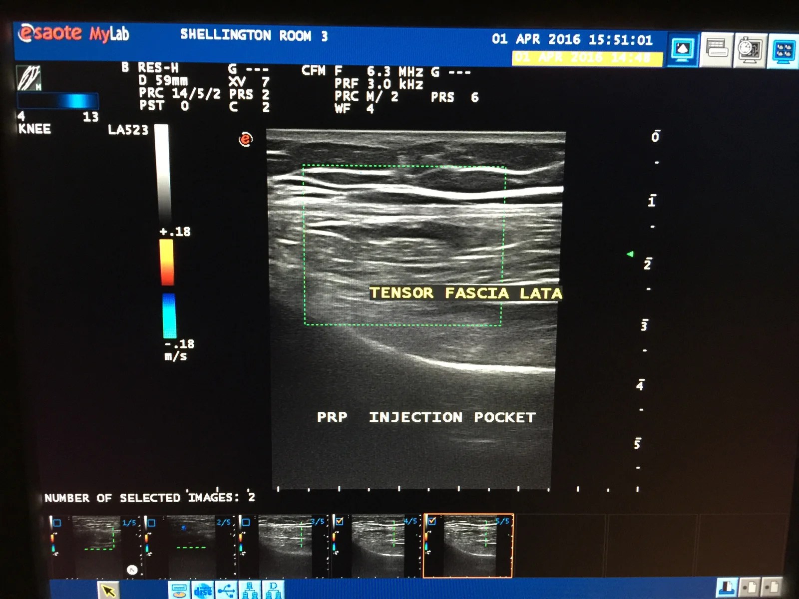 The Joint Clinic TM Gallery
