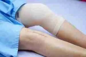 Is Metal Allergy A Concern In Hip And Knee Replacement Surgery? - Dr. Paul Norio Morton, Md, Faaos, Faahks 200_x_300_jpg