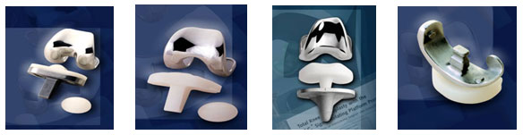 Types of Knee Replacements JointSurgery.in