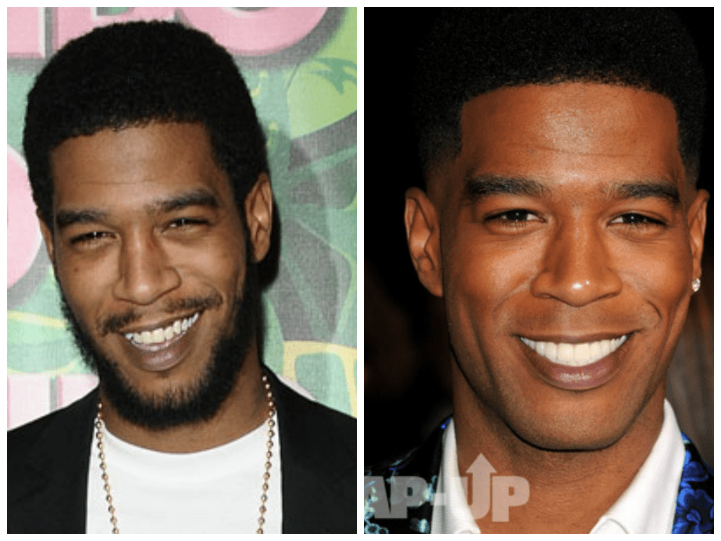 Changing Faces Kid Cudi Debuts New Teeth New Look At Need For