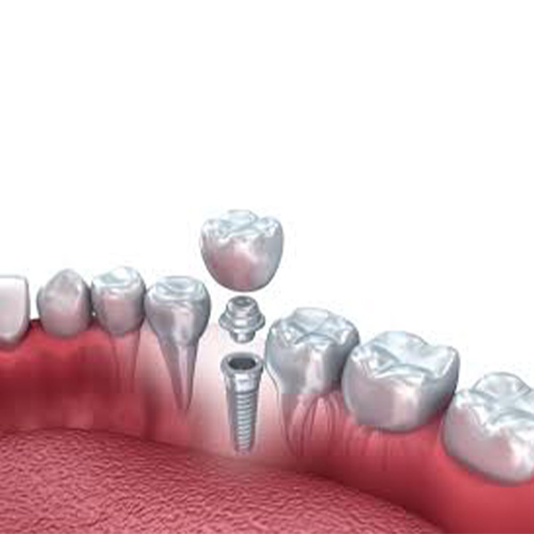 Dr. Jay Joseph DDS Joplin, MO Dentistry Best Dentist in Joplin