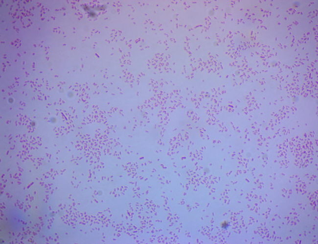 Gram Staining of Bacteria from Environmental Sources