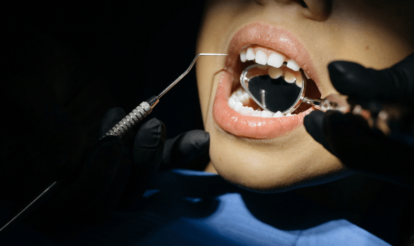 Top 5 Benefits Of Dental Space Maintainers for Kids Joyful Smiles