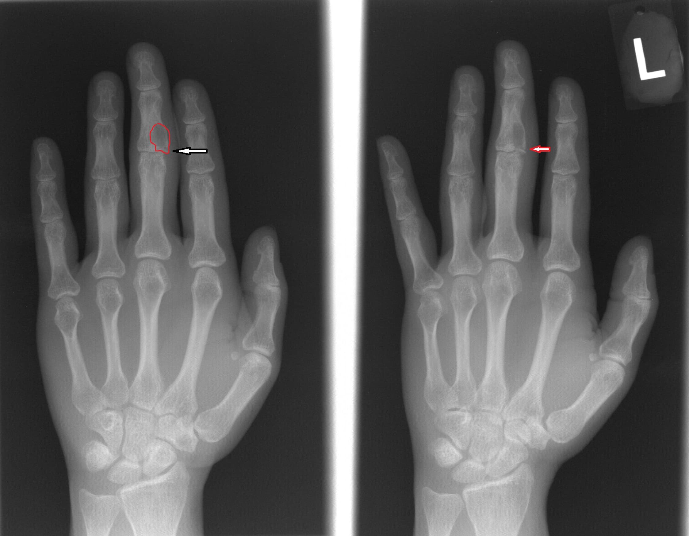 Woman with minor finger trauma Page 2 of 2 Journal of Urgent Care