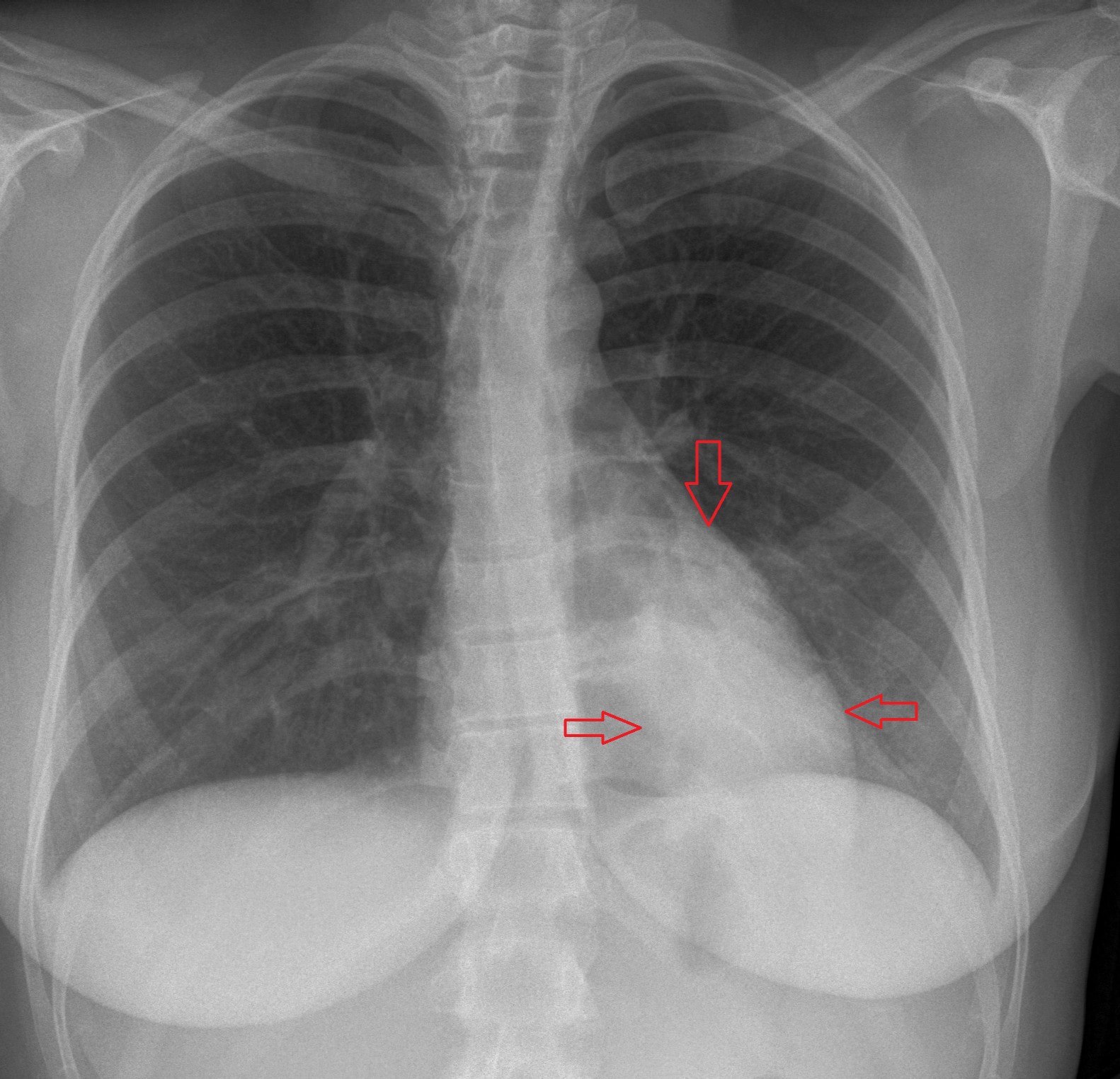 32yearold female presents with cough and fever Page 2 of 2