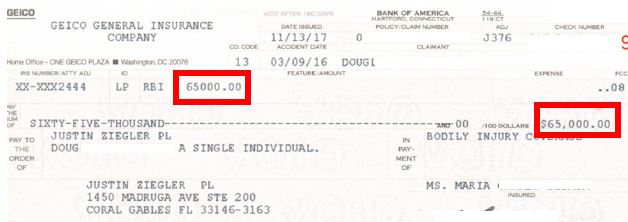 Broken Leg (Tibia & Fibula) Settlement Amounts Car Accidents and More
