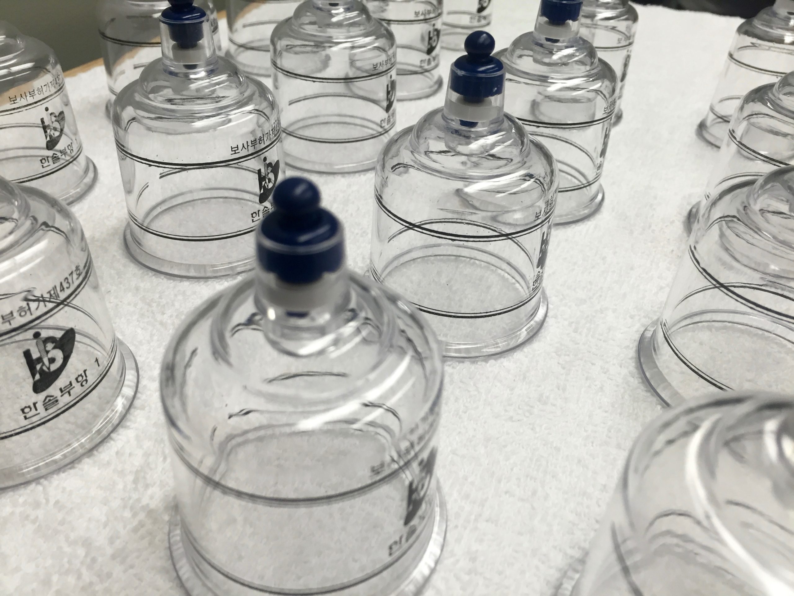 What is Cupping? justpeachy.co the official blog of Chia