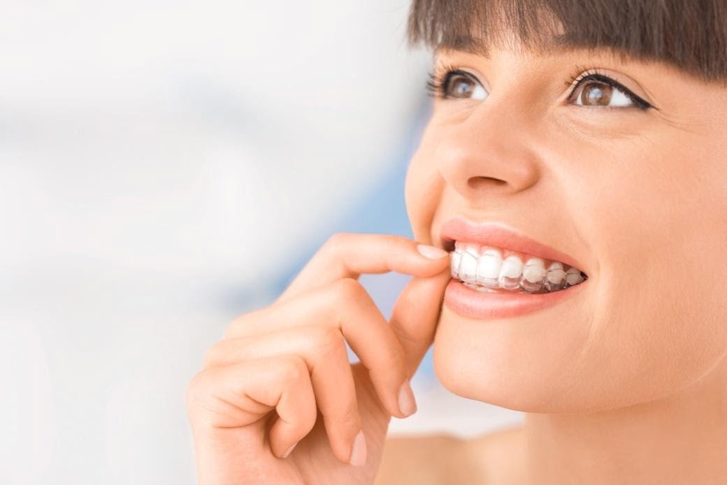 Everything You Need to Know About Teeth Alignment Treatment & Costs