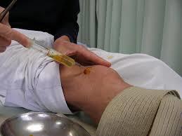膝 水 たまる 】 膝にたまった水を注射しないで抜く方法がこれです - Youtube | 膝 ストレッチ, 膝, エクササイズ ひざサポーター ひざの痛み 変形性ひざ軟骨症 ひざの変形 6０分以内で解消するものテラヘルツひざサポーター 痛み炎症を6０分以内で解消 綿100％