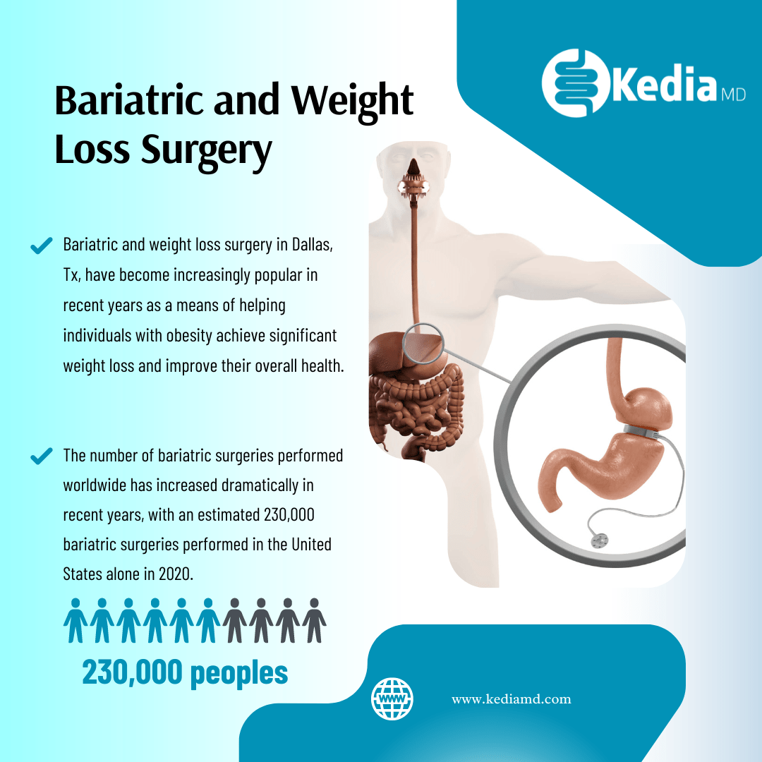 Who is a Candidate for Bariatric and Weight Loss Surgery Dallas Tx