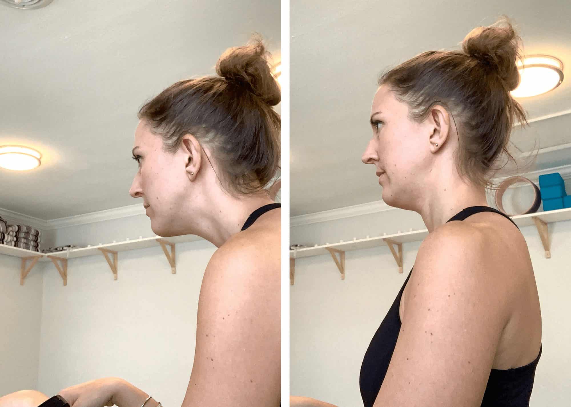 Why Your Tech Neck Hurts and What to Do About It Kelly