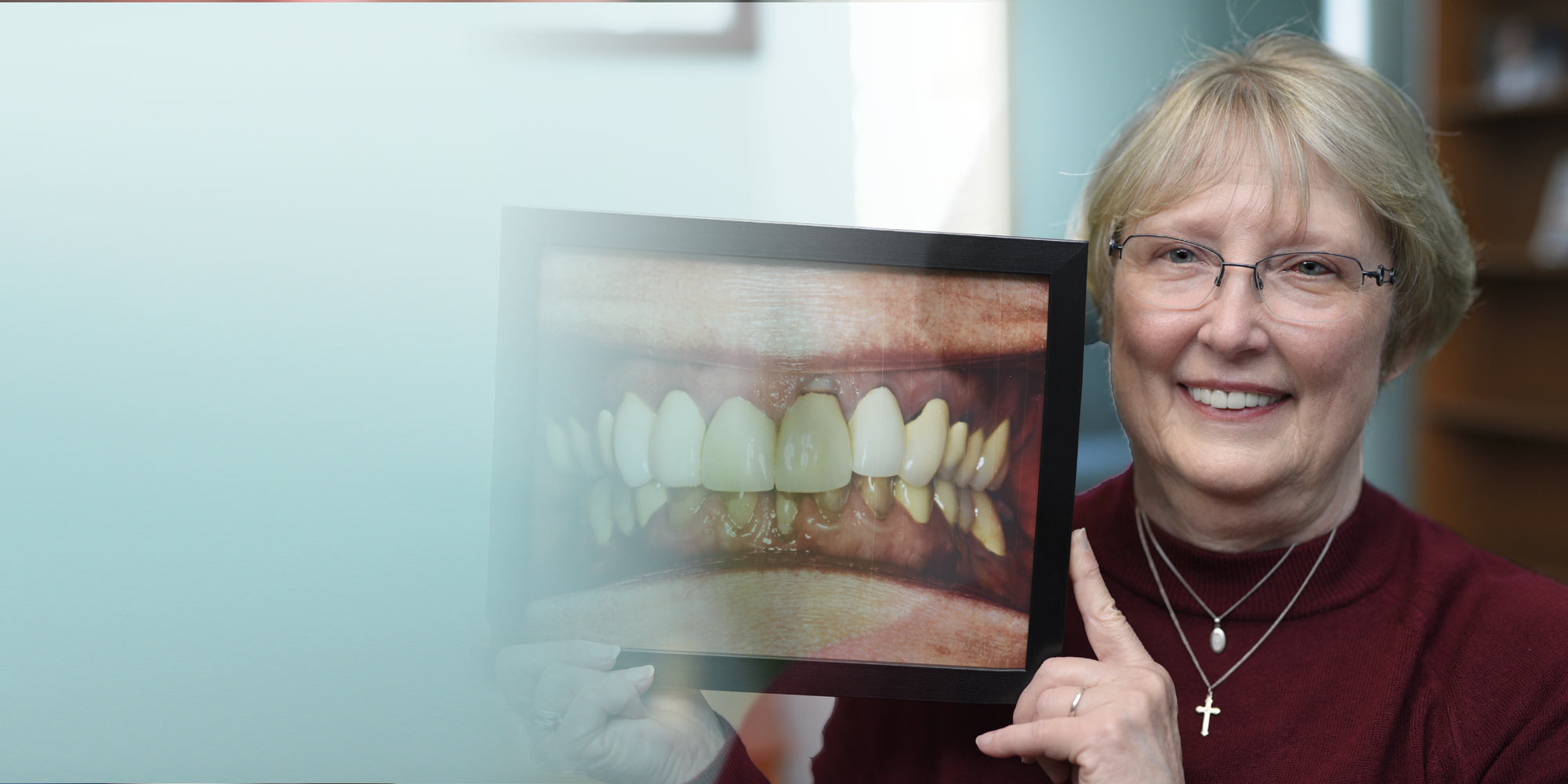 Before & After Photos C. Ackley II, DDS Lansing, MI