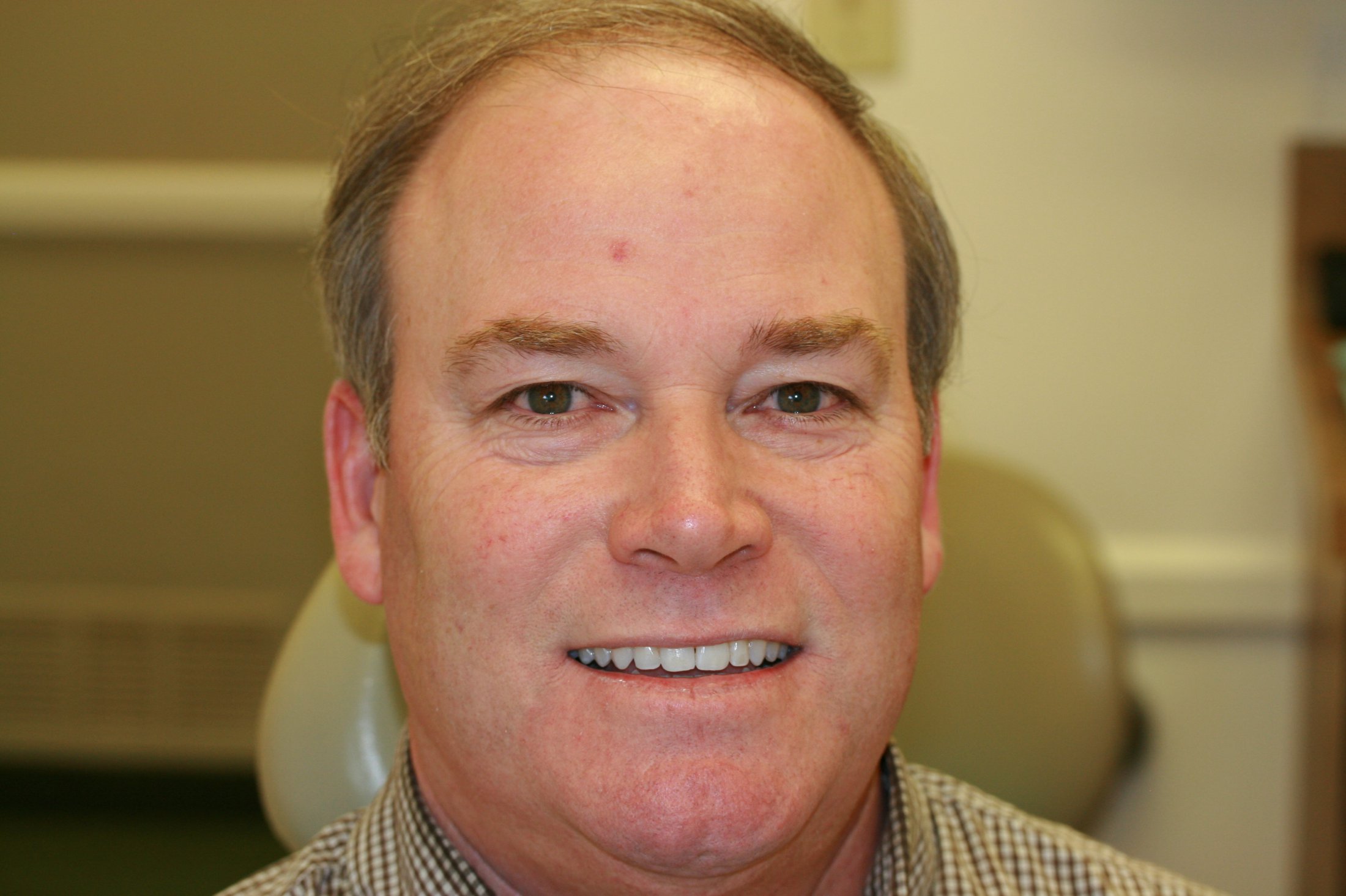 Smile Gallery C. Nash, DDS, Solvang CA