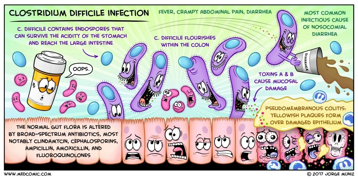 Learn about Clostridium difficile infection with a