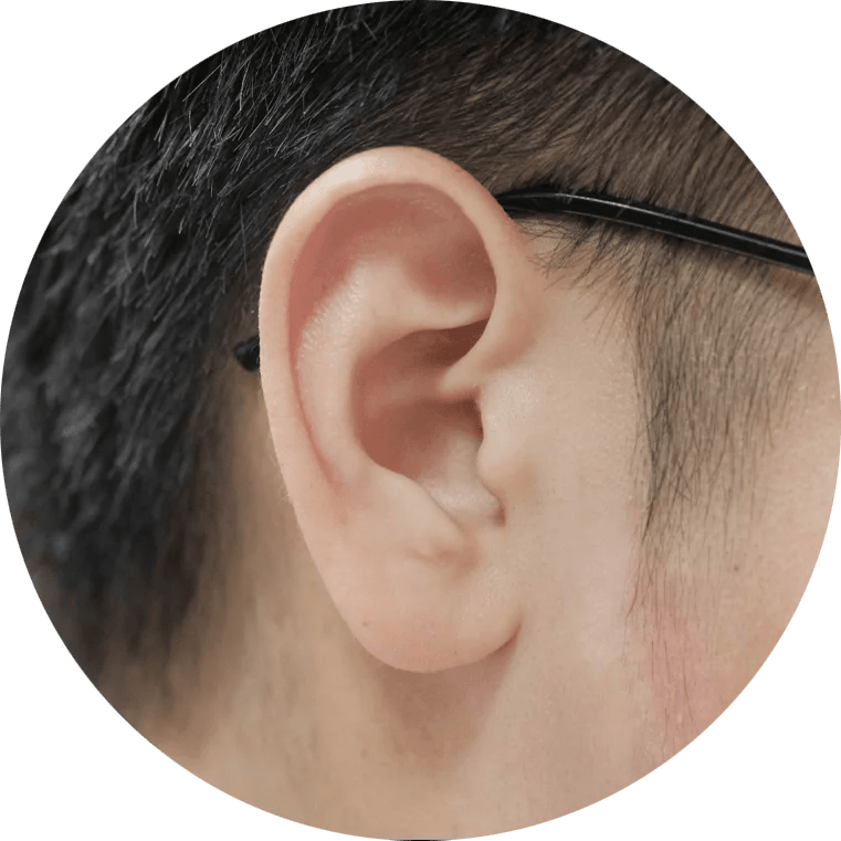 Ear Lobe Repair Madison and Pearl, MS Key Dental Group Keloid Removal