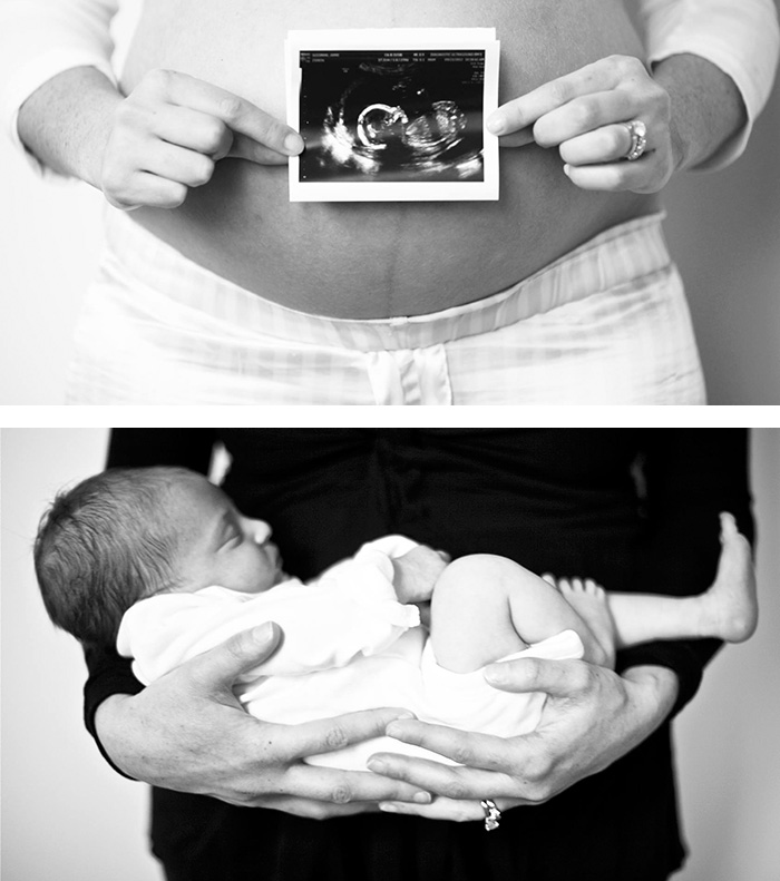 45 Lovely Photos Of Before And After Pregnancy!
