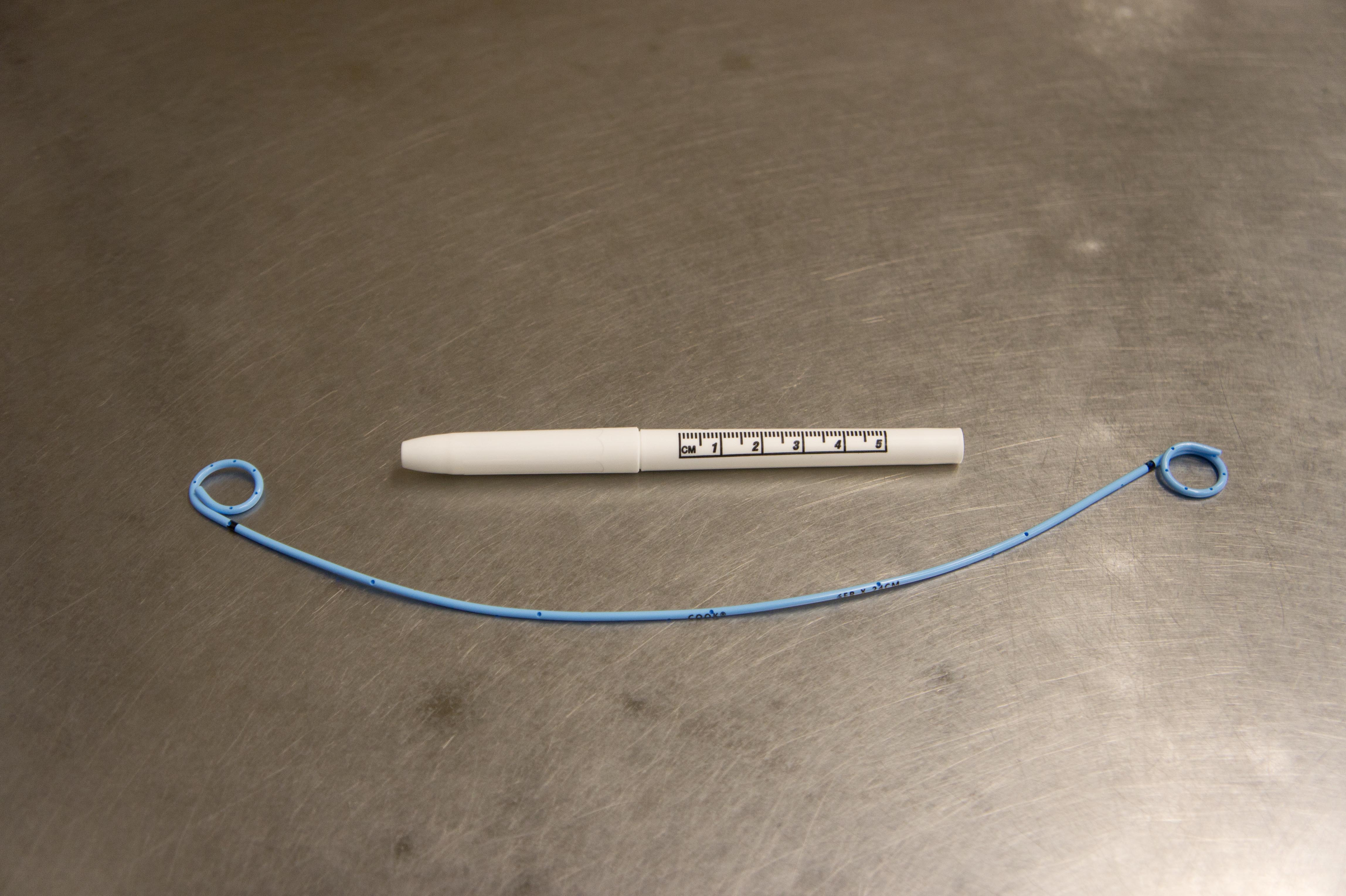 How is a ureteral stent placed?