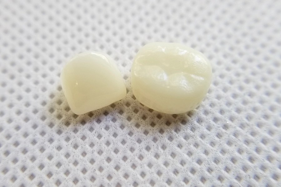 Zirconia Pediatric Crowns Kinder Krowns All Ceramic