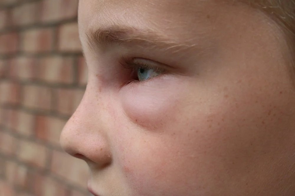 Wir sagen ihnen, wann sie dennoch zum arzt gehen sollten, und was zu. Kinderkrankheiten Tipps Und Infos Rund Um Kinderkrankheiten