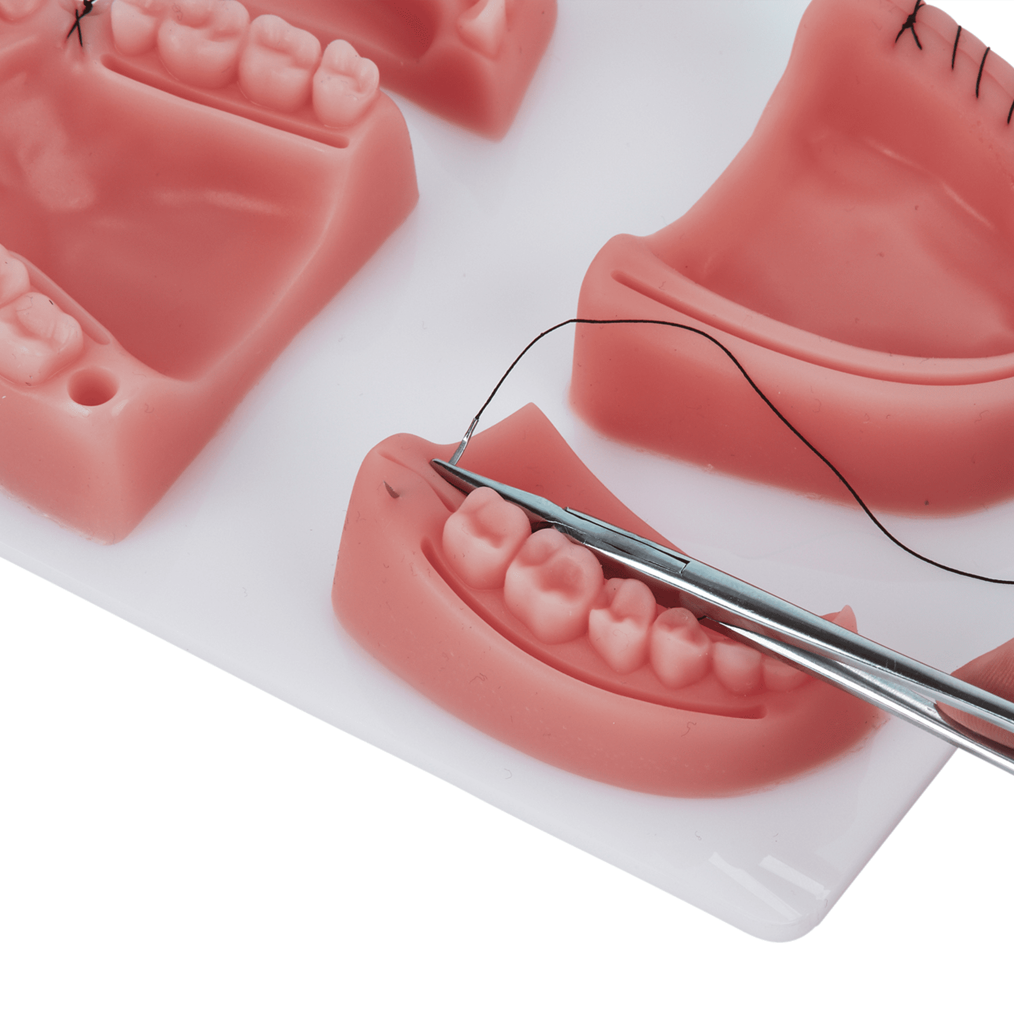When Do Dental Sutures Come Out at Walter Mathewson blog