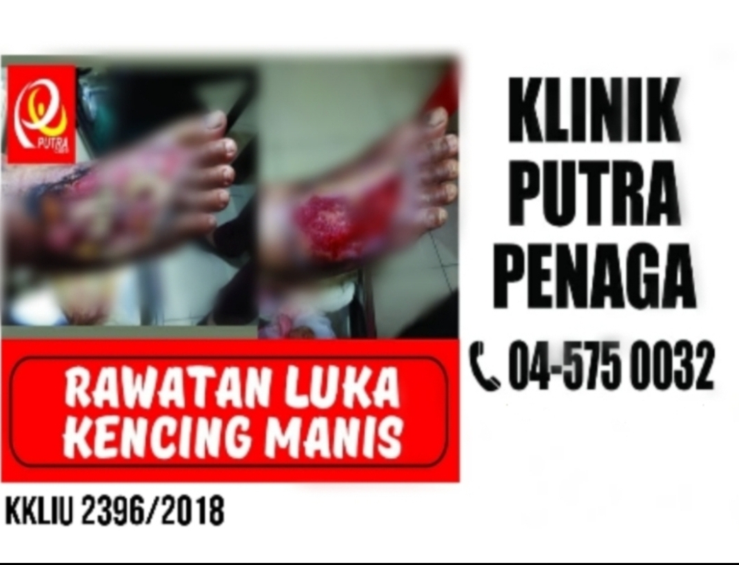 rawatan luka kencing manis Klinik Putra