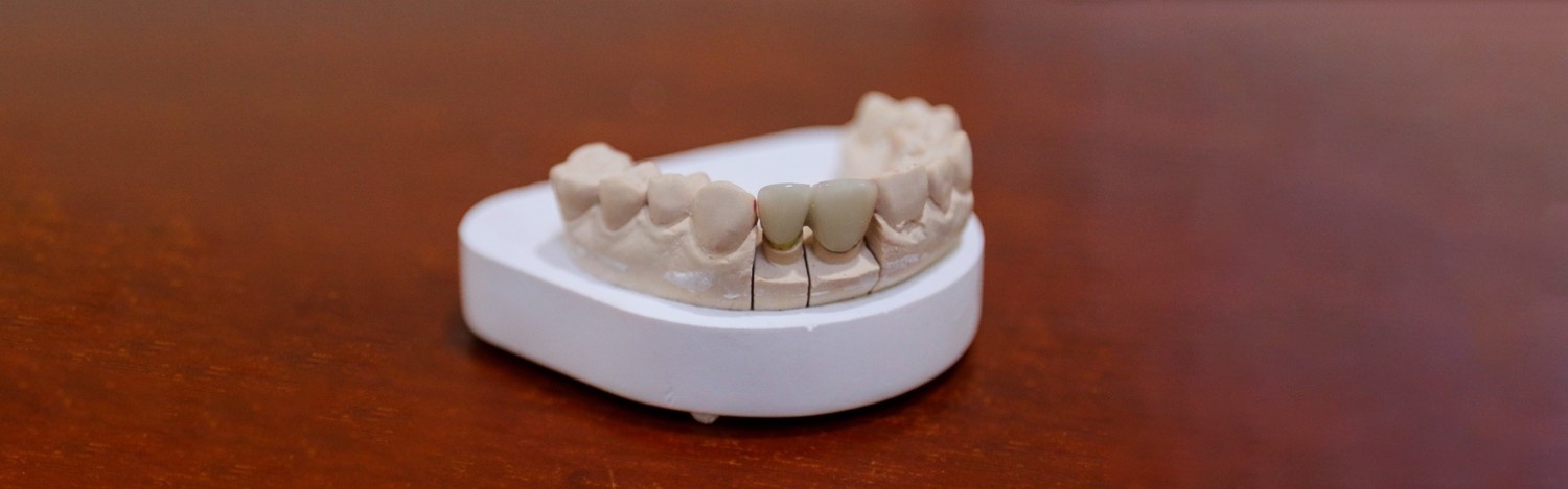Your Comprehensive Guide to the Basic Restorative Dental Services