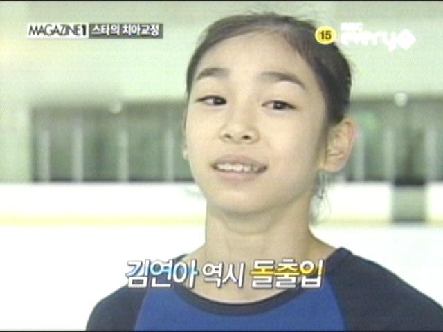 All 7 of These Idols Did This Cosmetic Surgery and Changed Their Faces