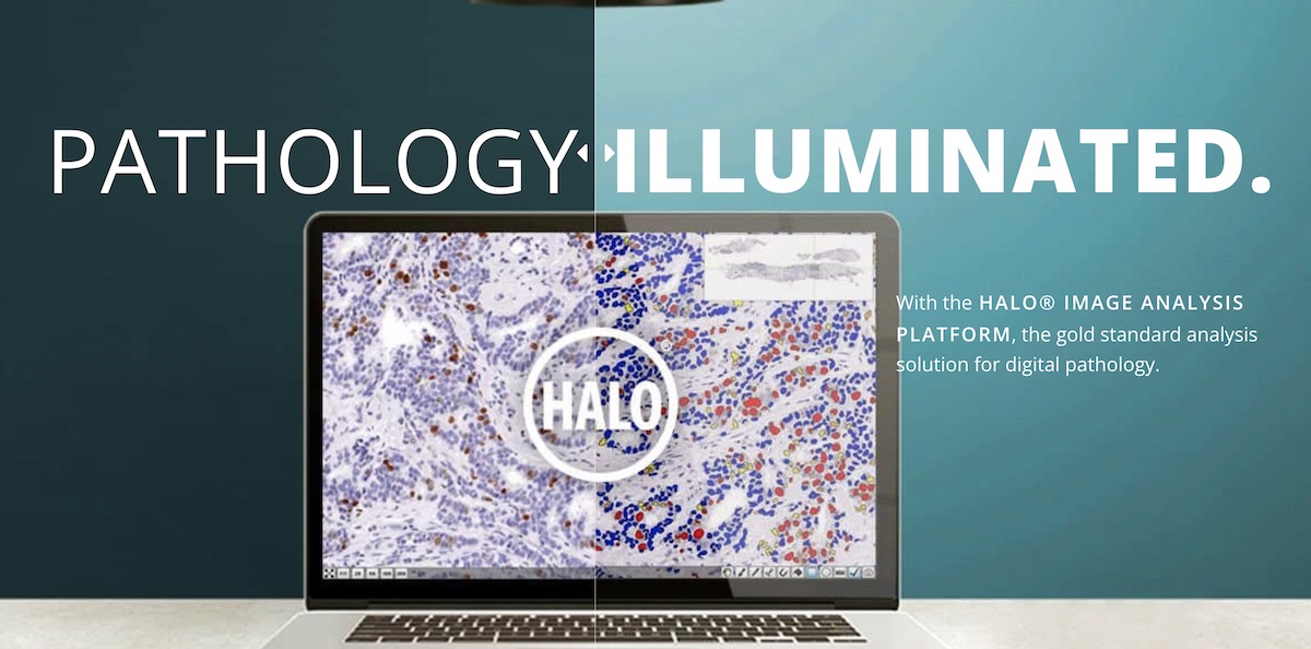 Indica Labs Launches Comprehensive Management Service for HALO