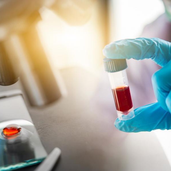 Covd19 Neutralizing Antibody quantitative test