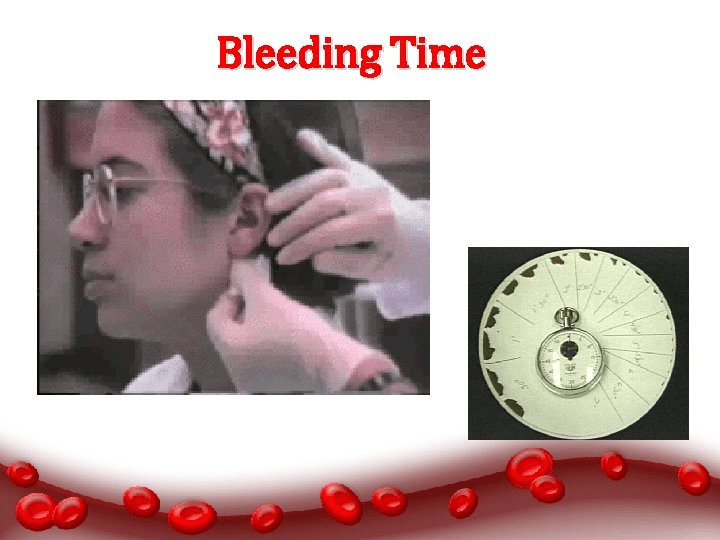 Bleeding Time BT