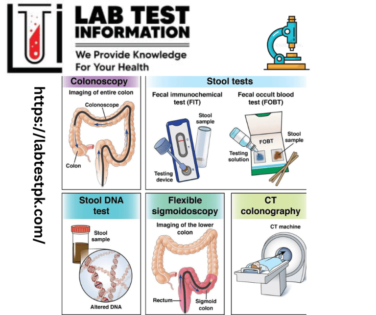 Stool Occult Blood Test